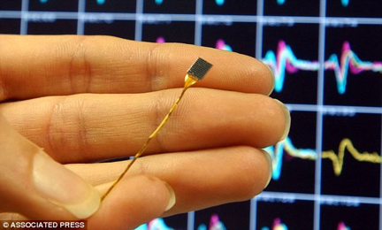 (Picture of the memory implant via Google)